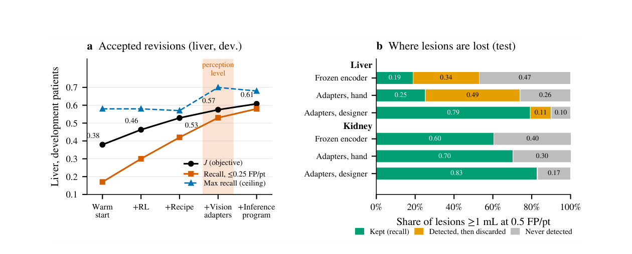 Paper Figure 3: accepted revisions on liver development patients and where lesions are lost on the test set.